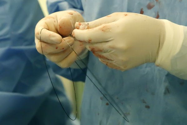 Katéteres műtő műtét közben