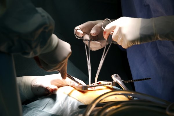Szívsebészeti műtő műtét közben